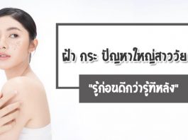 ฝ้า-กระ-ปัญหาใหญ่สาววัย-30-รู้ก่อนดีกว่ารู้ทีหลัง